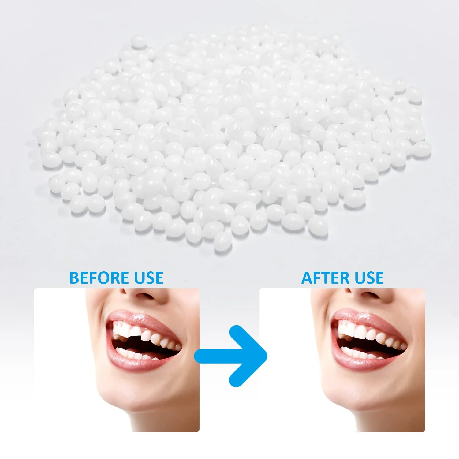 20g Temporary Tooth Restoration Beads with 5 Floss Sticks, Tooth Filling Replacement, Missing Tooth Broken Tooth Filling Material for Missing Denture Defects