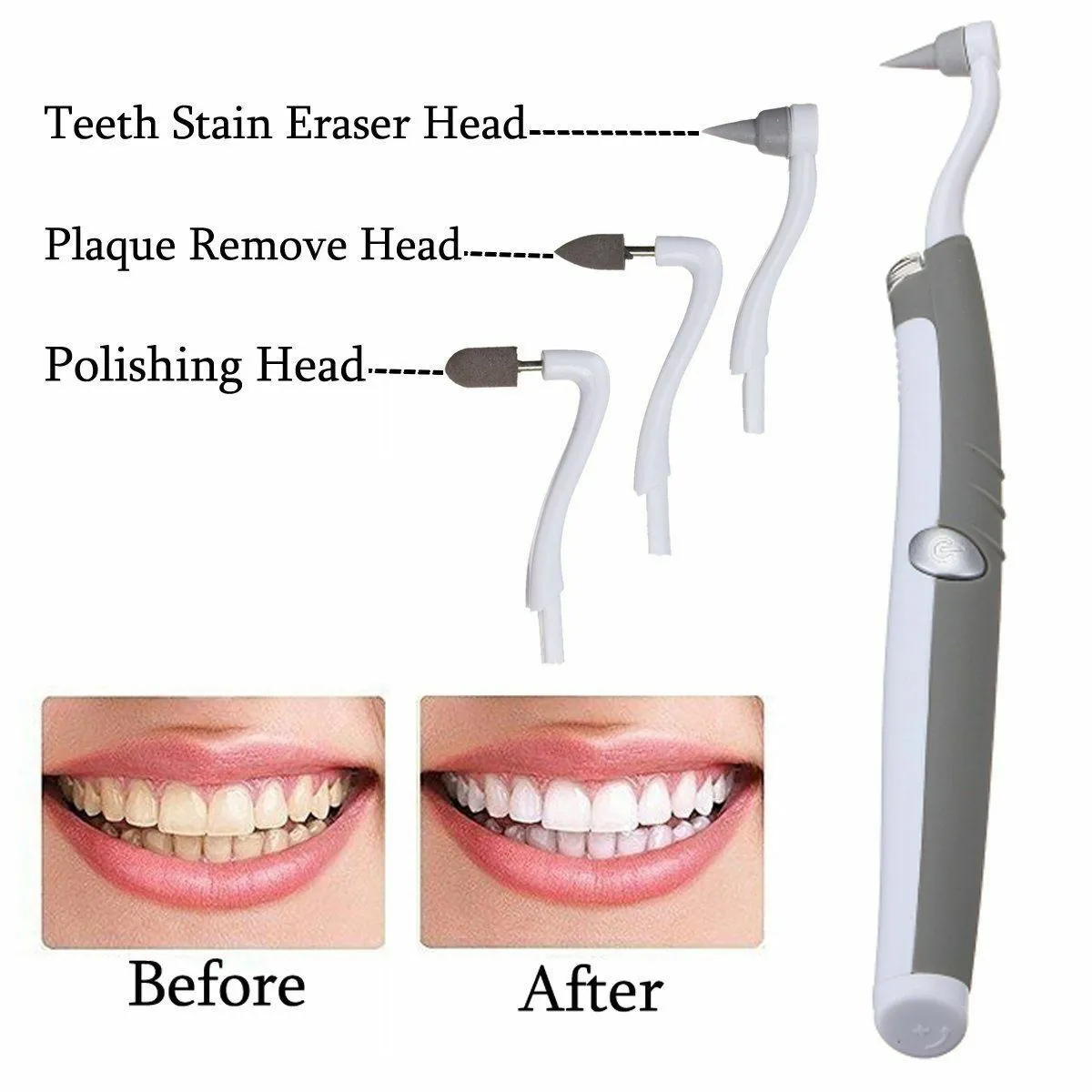 3 in 1 SONIC TOOTH STAIN ERASER WITH PLAQUE REMOVER