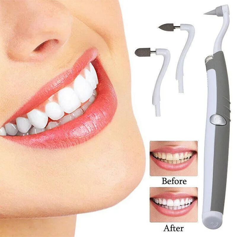 3 in 1 SONIC TOOTH STAIN ERASER WITH PLAQUE REMOVER