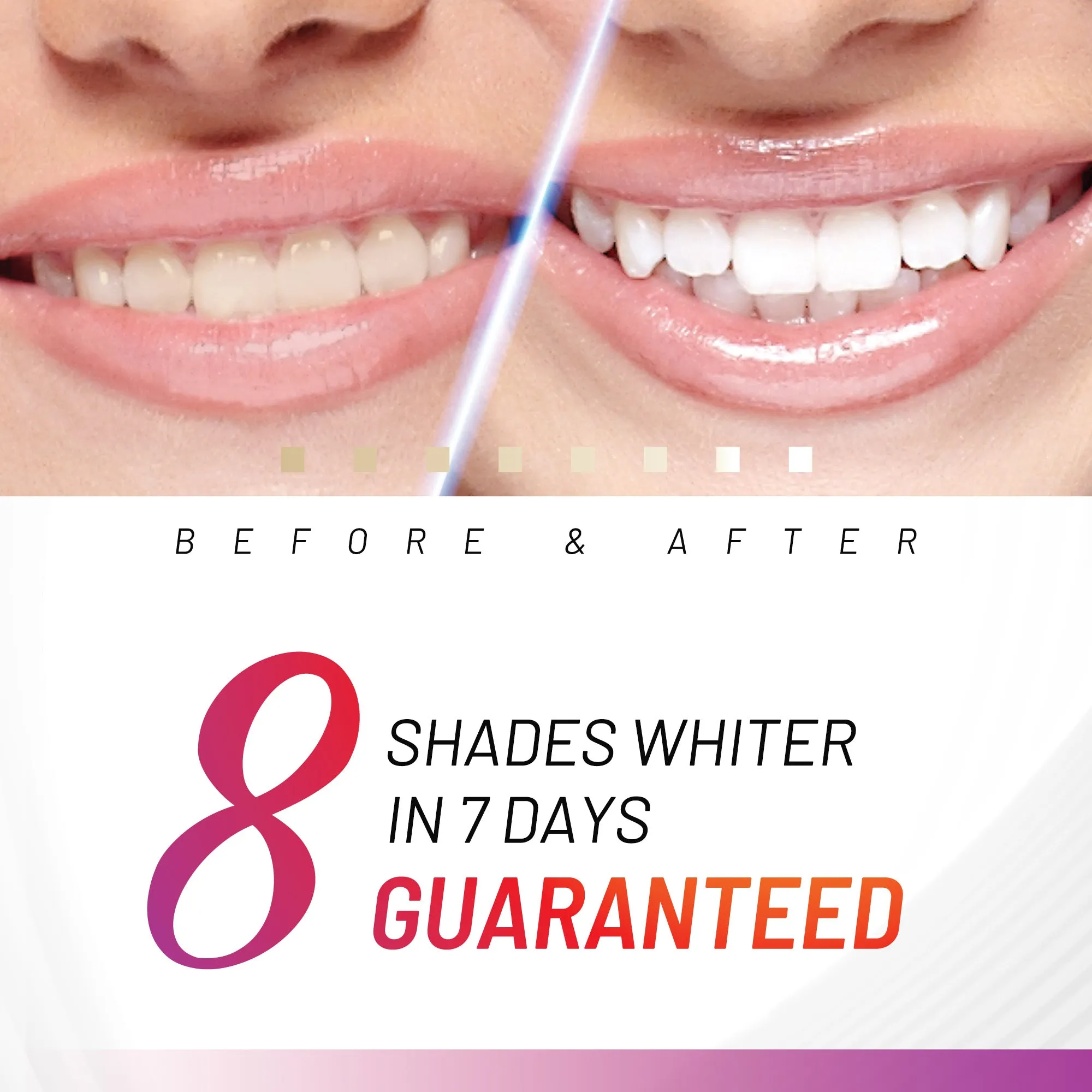 Accelerator Teeth Whitening Kit