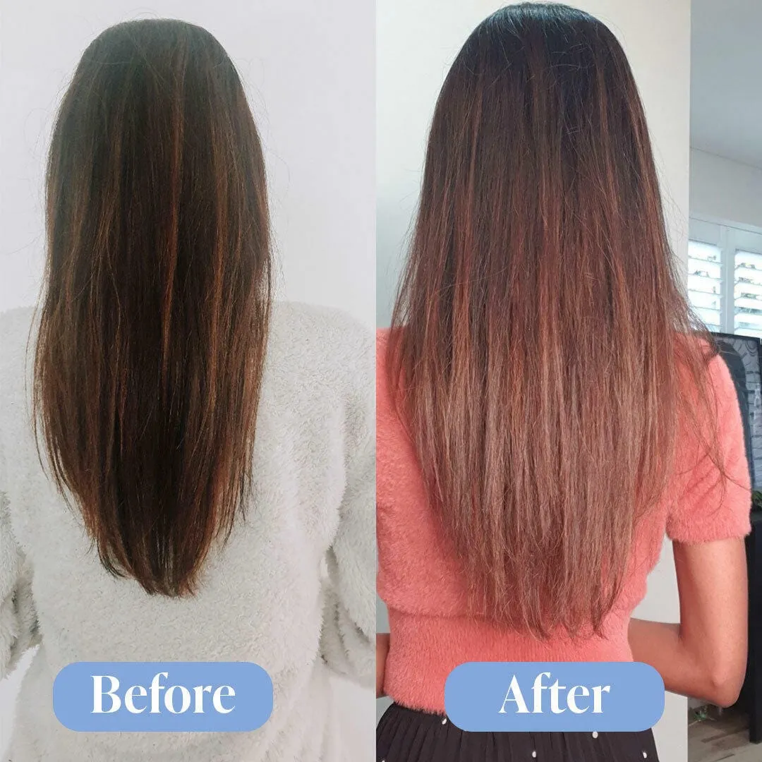 Anti-Hair Loss Treatment Bundle