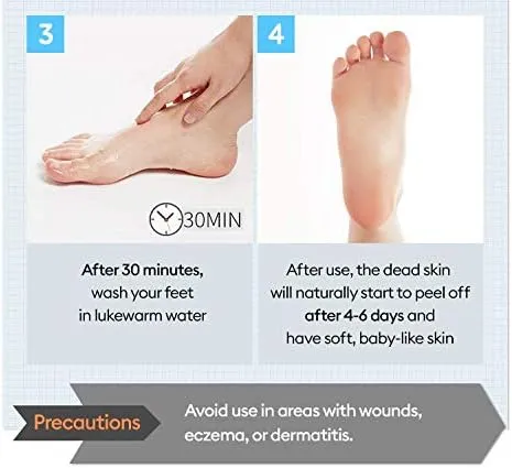 A'pieu Soft Foot Peeling Socks 40ml
