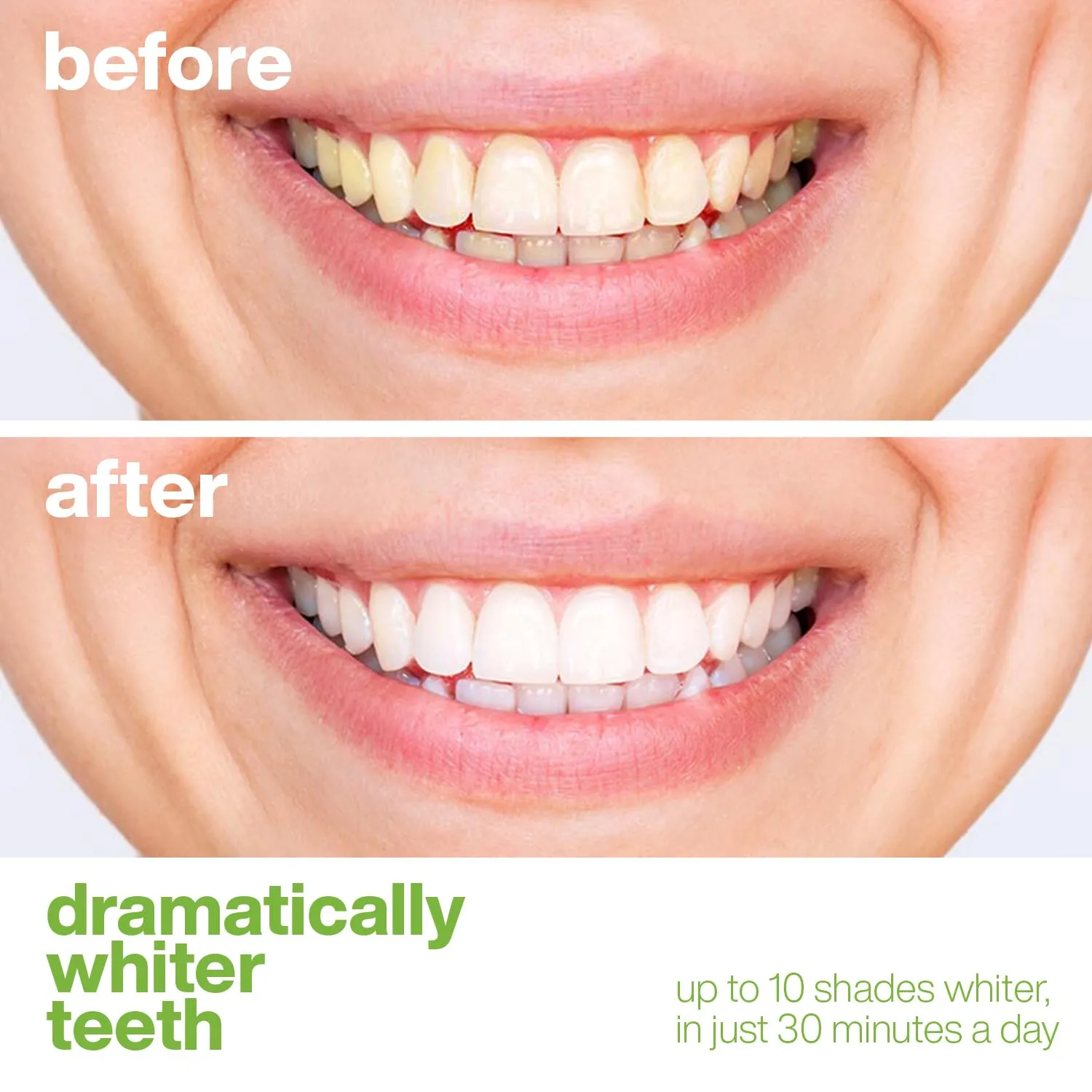 AquaSonic Professional Teeth Whitening Strips - Enamel Safe Teeth Whitening with Hydrogen Peroxide - Easy to Use, Non-Slip, Affordable & Effective (Spearmint) Spearmint