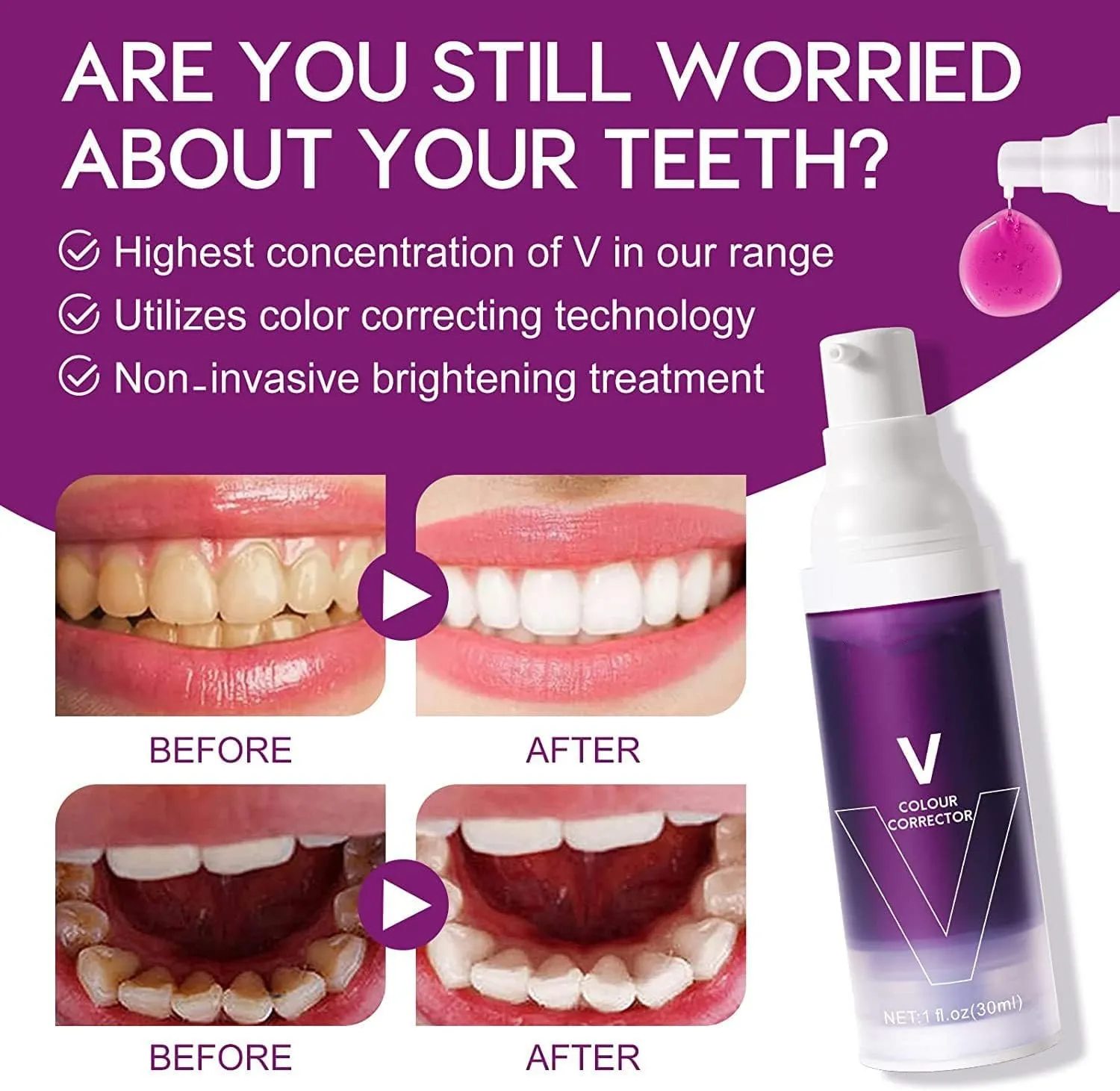 Azonee Teeth Whitening Toothpaste