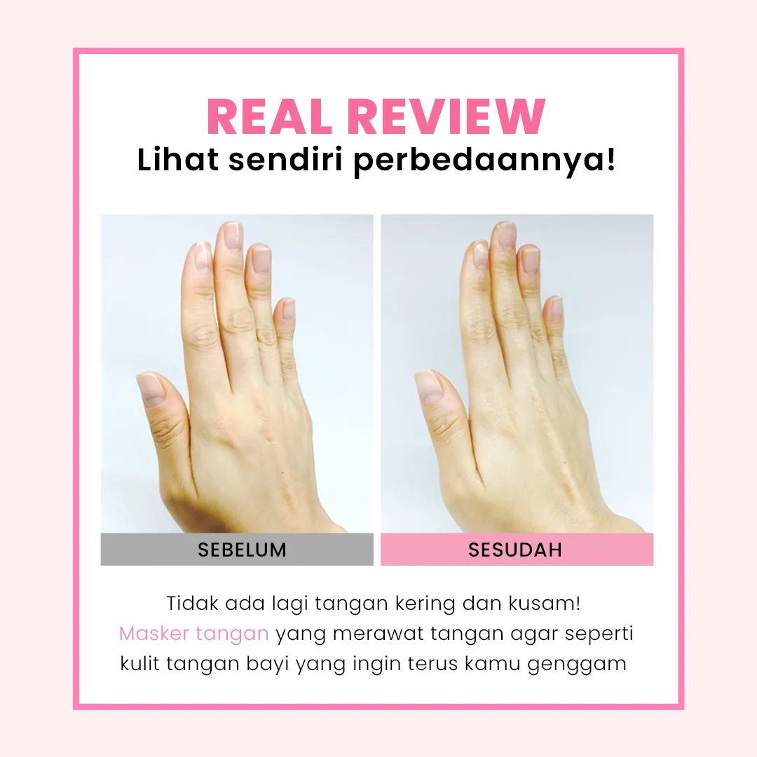 Baby Silky Hand Mask Sheet | Masker Tangan