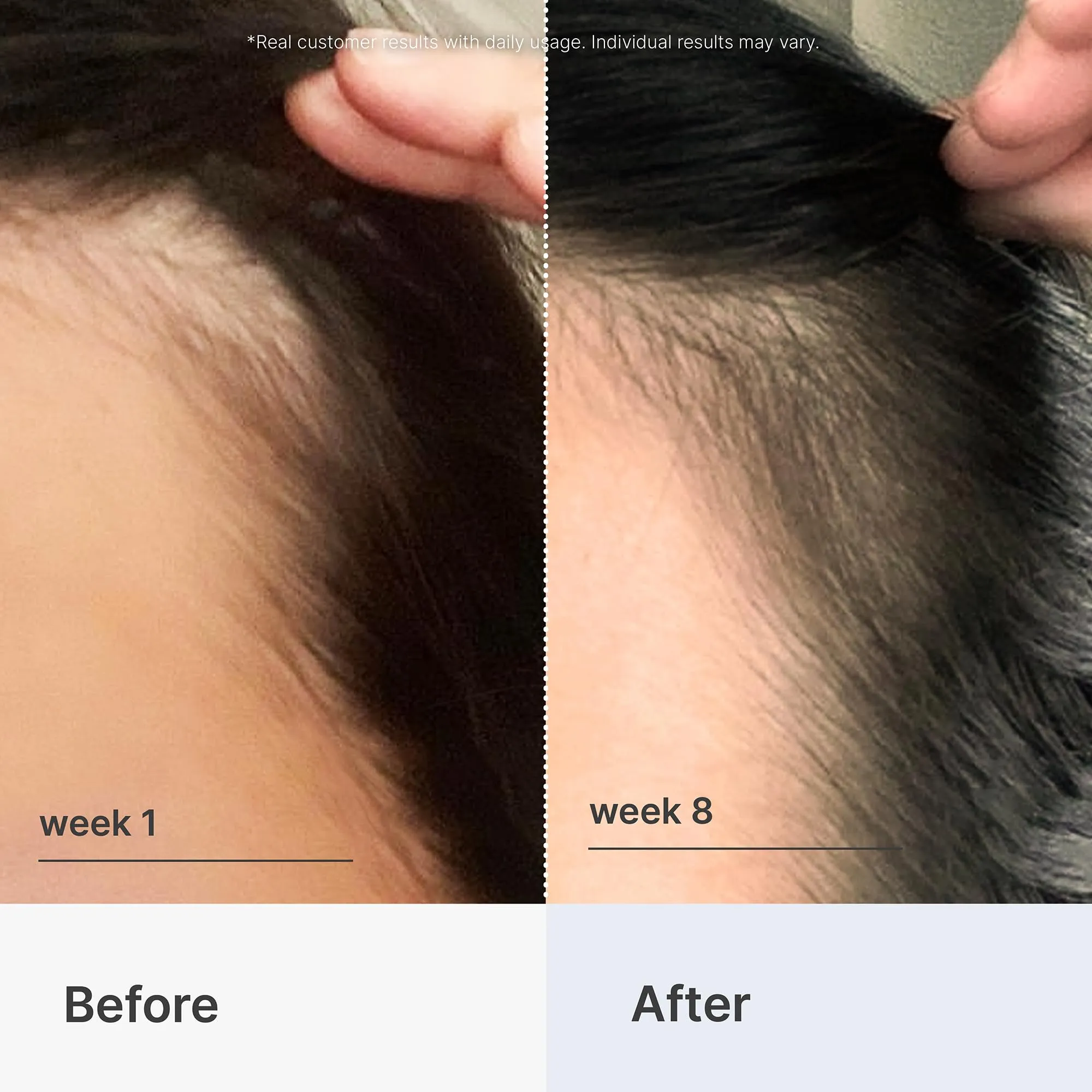 Better Not Younger Superpower Hair & Scalp Duo Set - Fortifying Hair & Scalp Serum 2fl.oz. plus Liquid Comb - Leave-in Hair Serum w/ Scalp Massaging Applicator for Stronger, Thicker, Fuller Hair