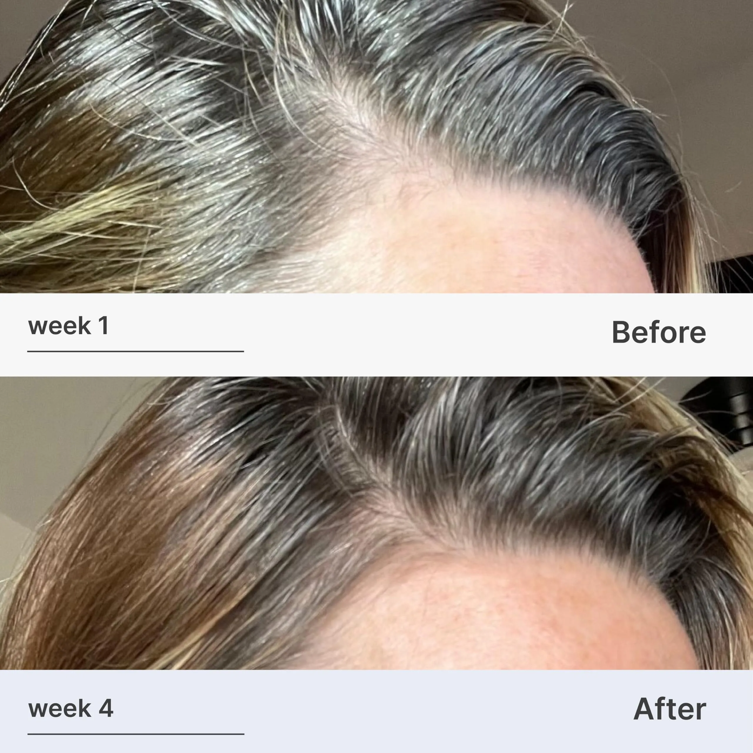 Better Not Younger Superpower Hair & Scalp Duo Set - Fortifying Hair & Scalp Serum 2fl.oz. plus Liquid Comb - Leave-in Hair Serum w/ Scalp Massaging Applicator for Stronger, Thicker, Fuller Hair