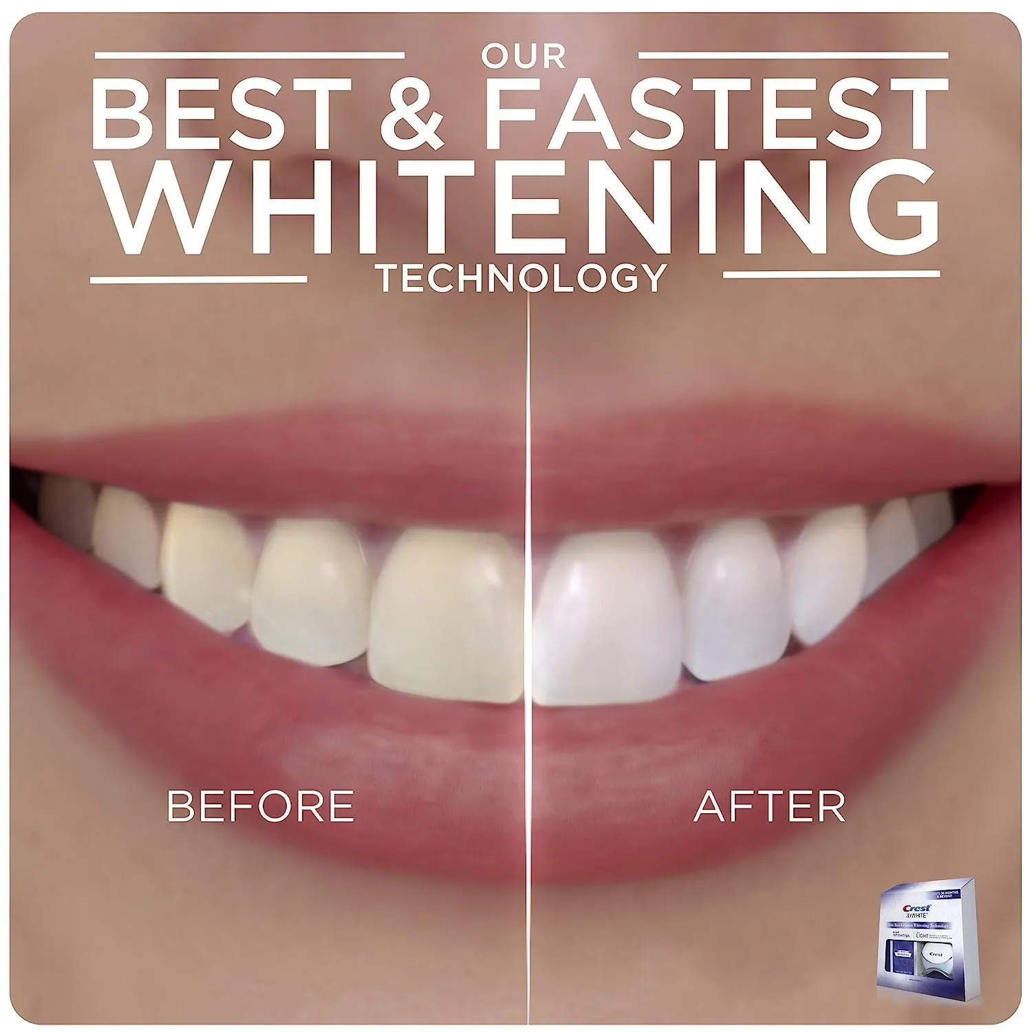Crest 3D Whitestrips Teeth Whitening Kit, 20 Strips