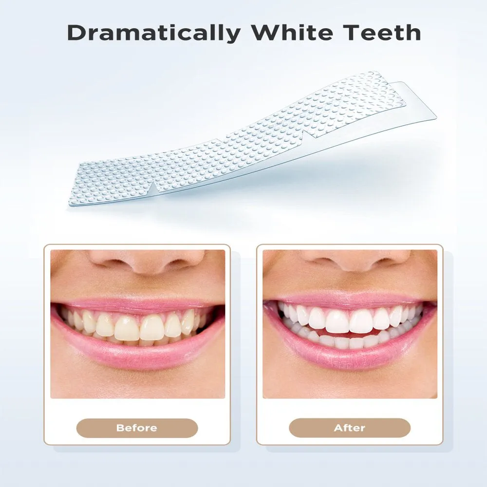 Fairywill Teeth Whitening Strips Non-Sensitive White Strips , Teeth Whitening Kit 28 Strips Remove Smoking Coffee Soda Stain