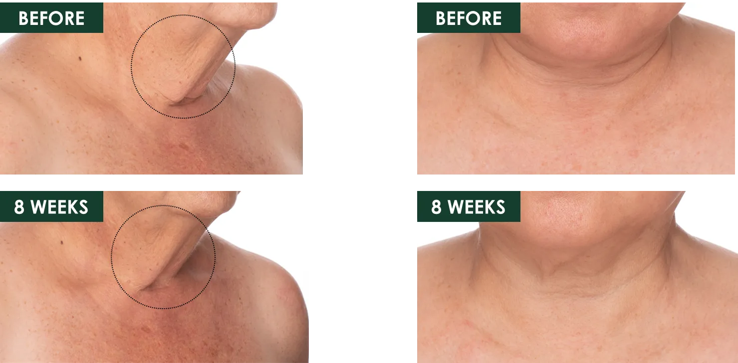 Fermitif Neck Renewal Serum / Firming Treatment