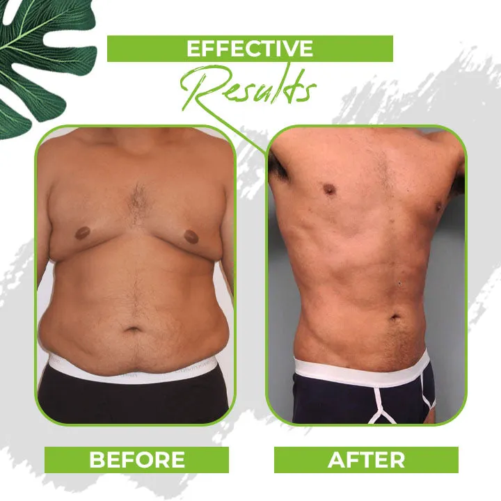 Fit-Genie Pro™ Herbal Slimming Waist Pellet🌿