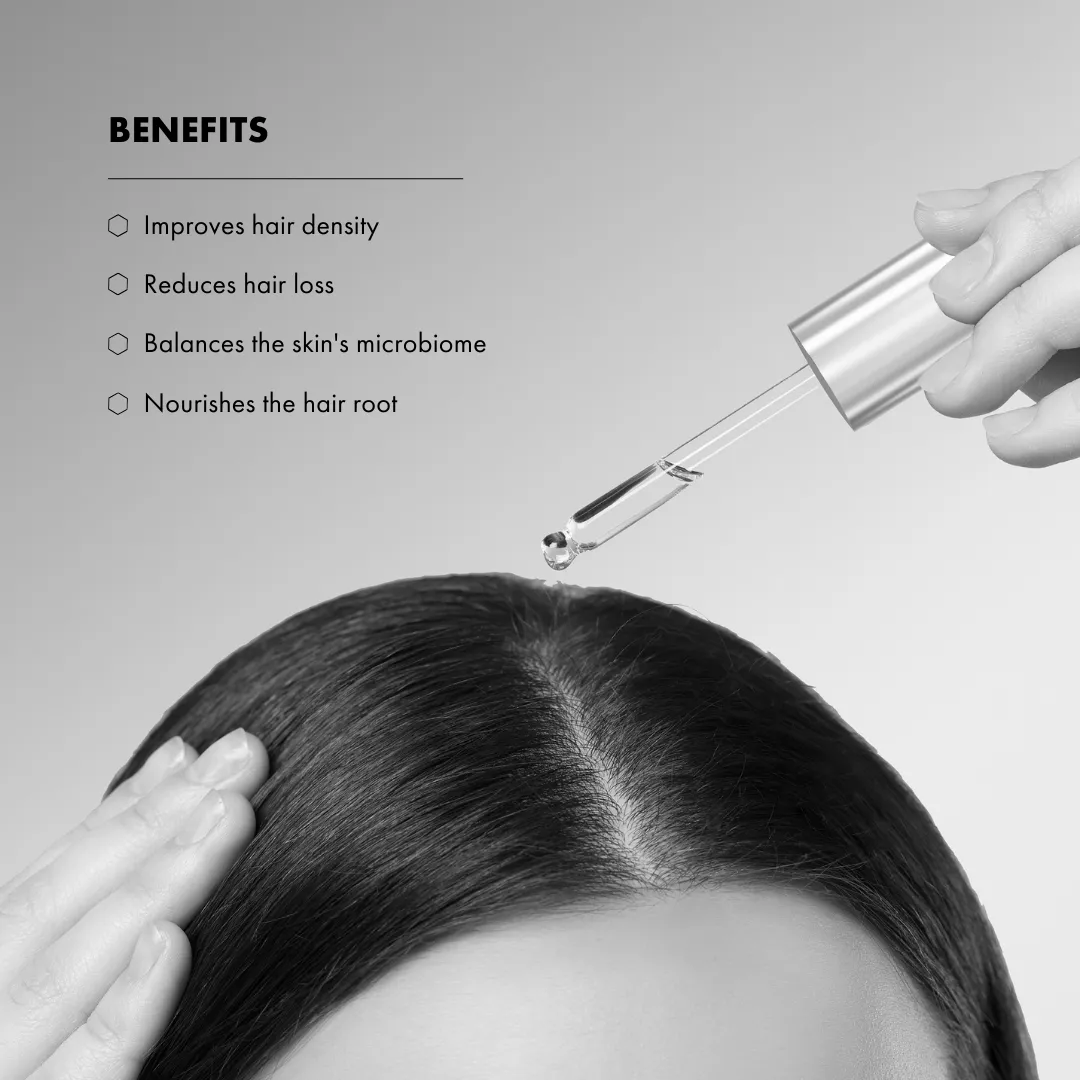 FOLLICare Scalp Treatment