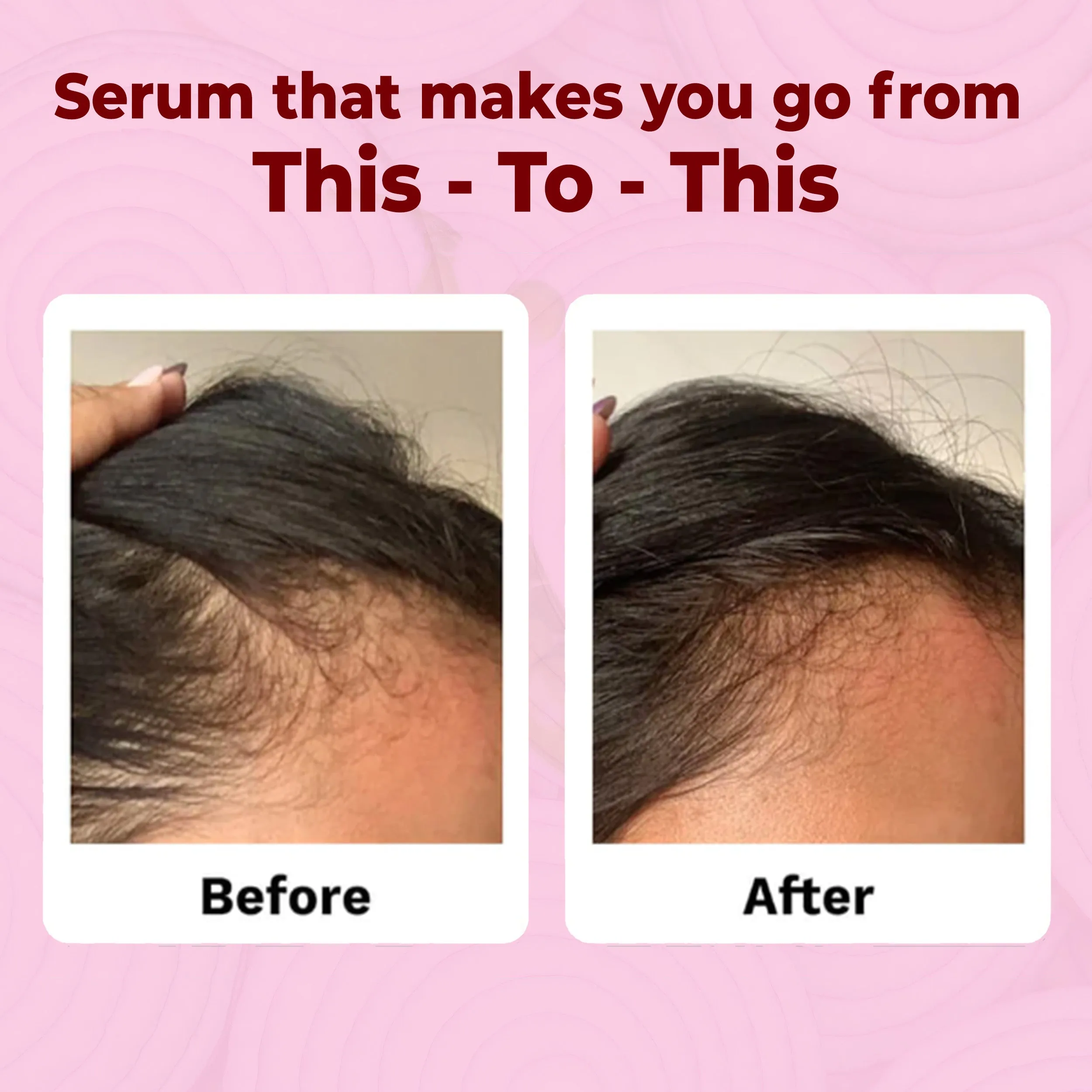 Good Vibes Hair Fall Control Onion Scalp Serum | Onion Extracts | Pea Sprout Extracts | Healthy Hair Growth | Hair Nourishment | Enhances volume | All hair Types - 50ml
