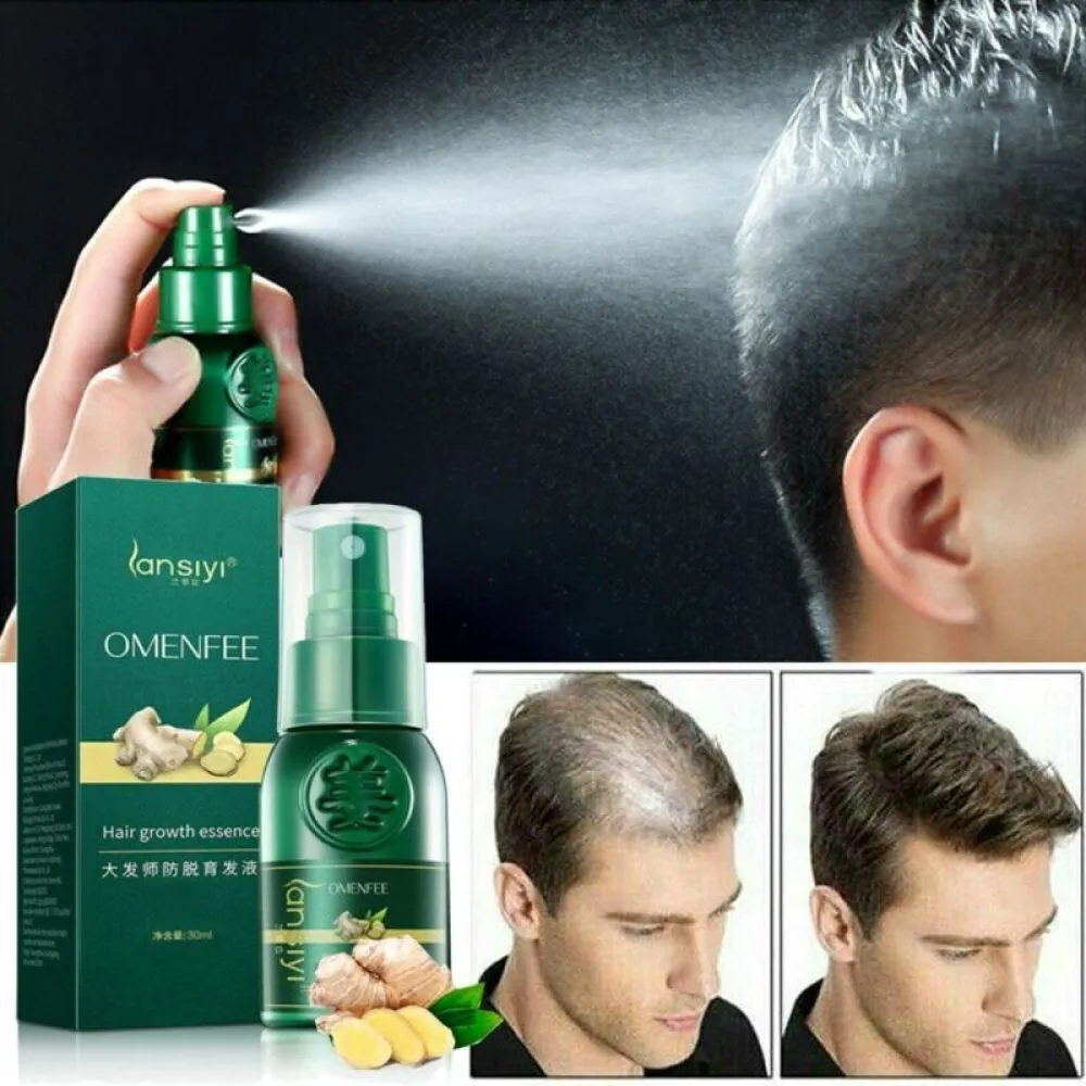 Hair Growth Serum Spray Dense Fast Regrowth Ginger Oil Hair Loss Treatment Care