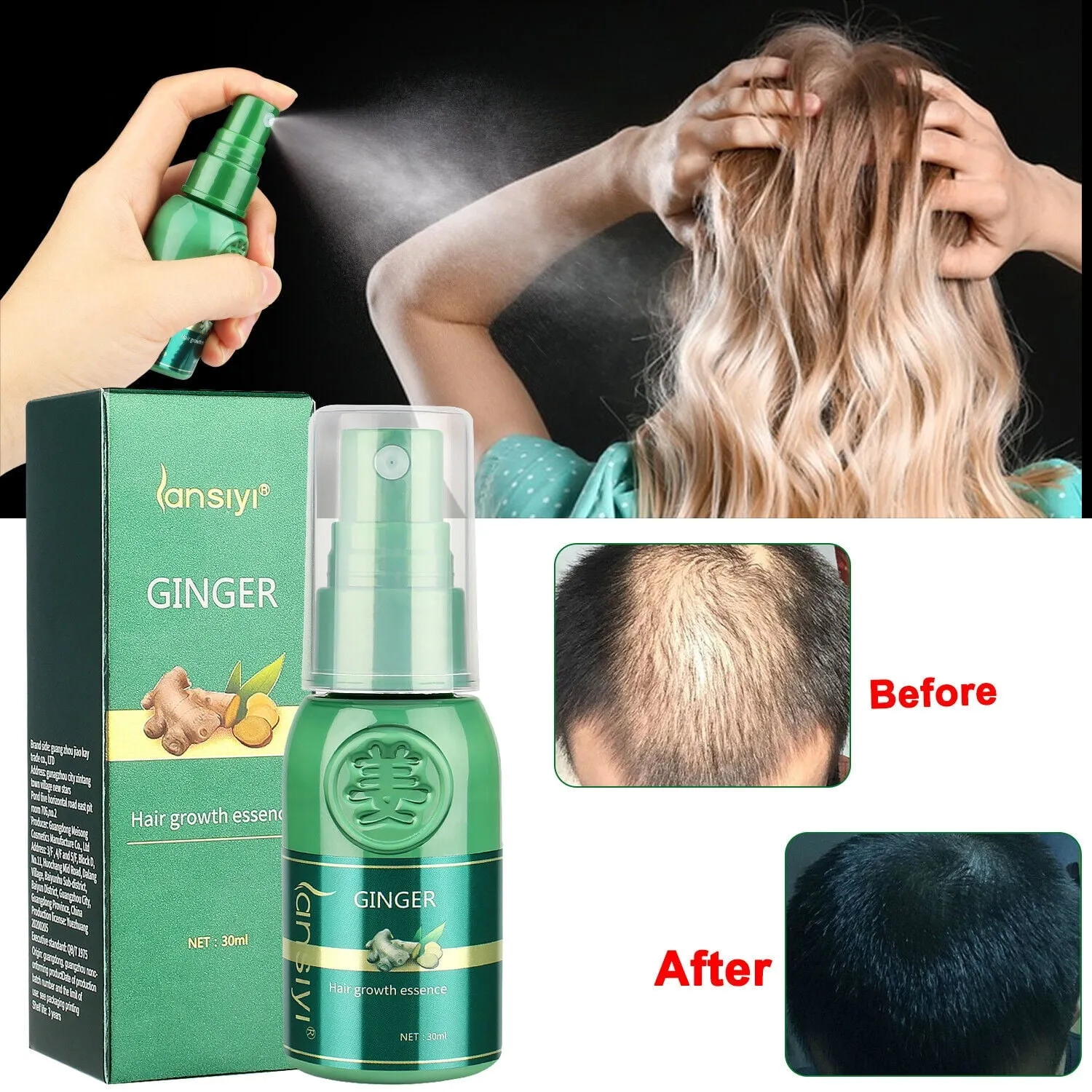 Hair Growth Serum Spray Dense Fast Regrowth Ginger Oil Hair Loss Treatment Care