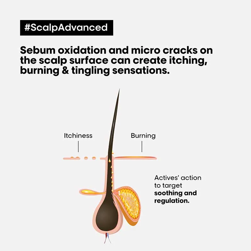 L'Oréal Professionnel Serié Expert Scalp Advanced Anti-Discomfort Hair Treatment