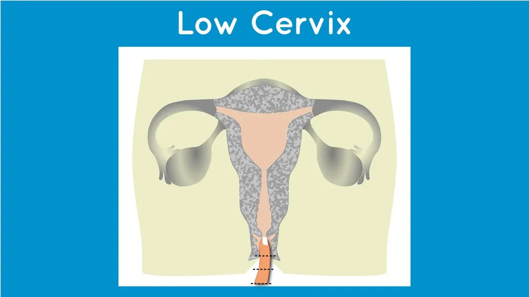 Low cervix menstrual cup by mermaid® (w/o box)