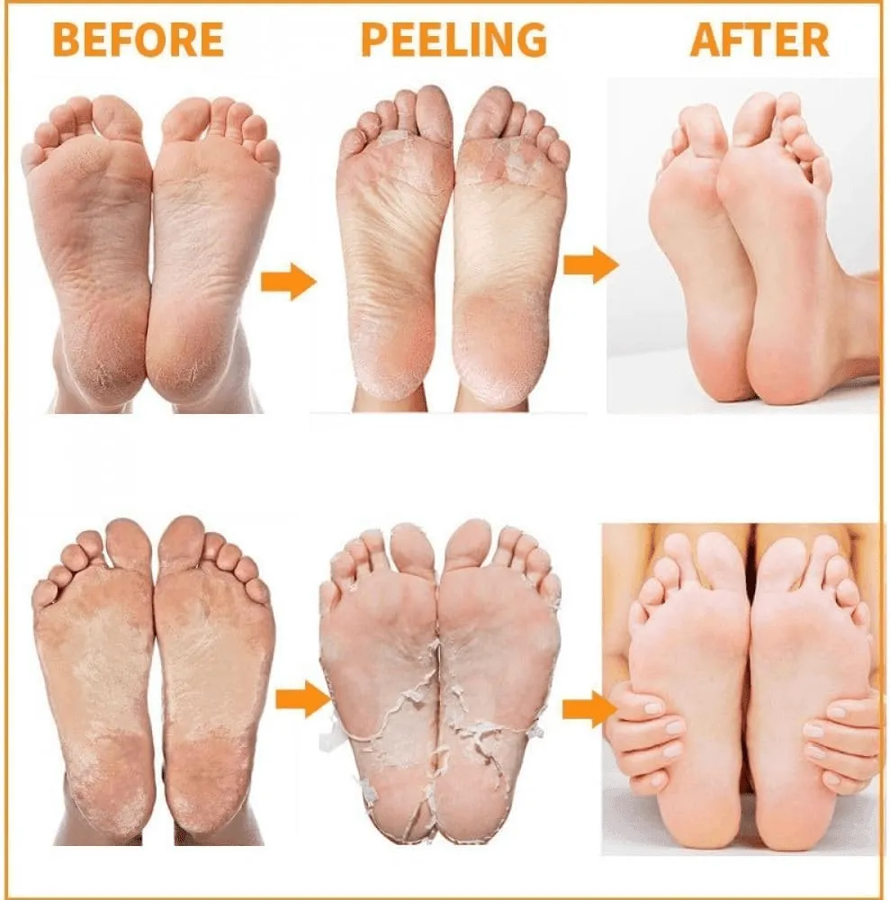 MBeauty Exfoliating Magic Foot Socks 1 Pair