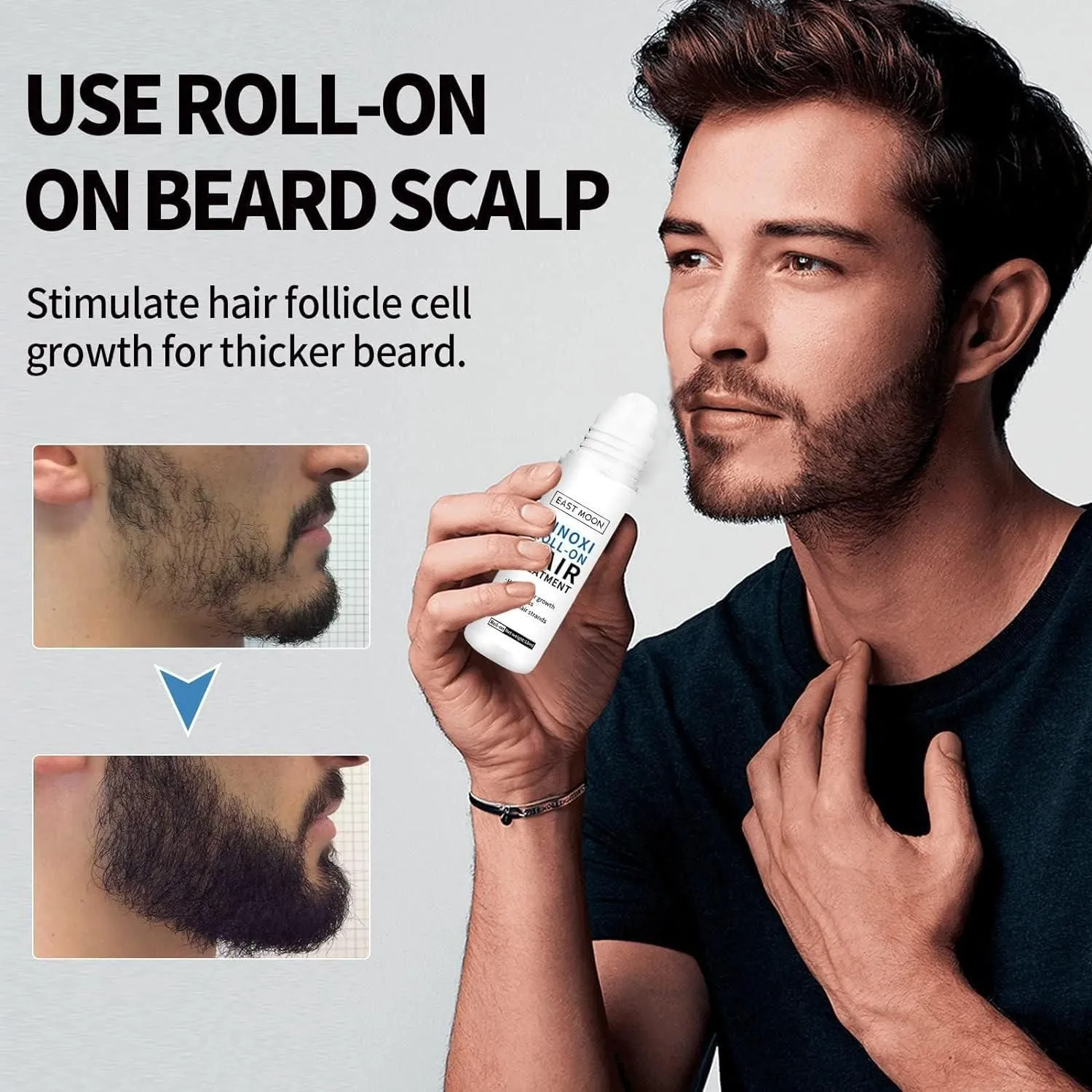 Minoxi Roll-On Hair Treatment Hair Growth Serum (Buy 1 Get 1 Free)