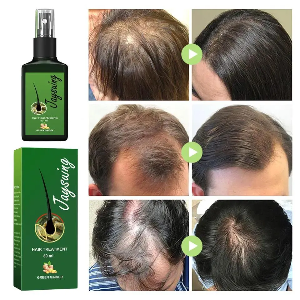 Natural Ginger Hair Growth Spray Jaysuing 120ml