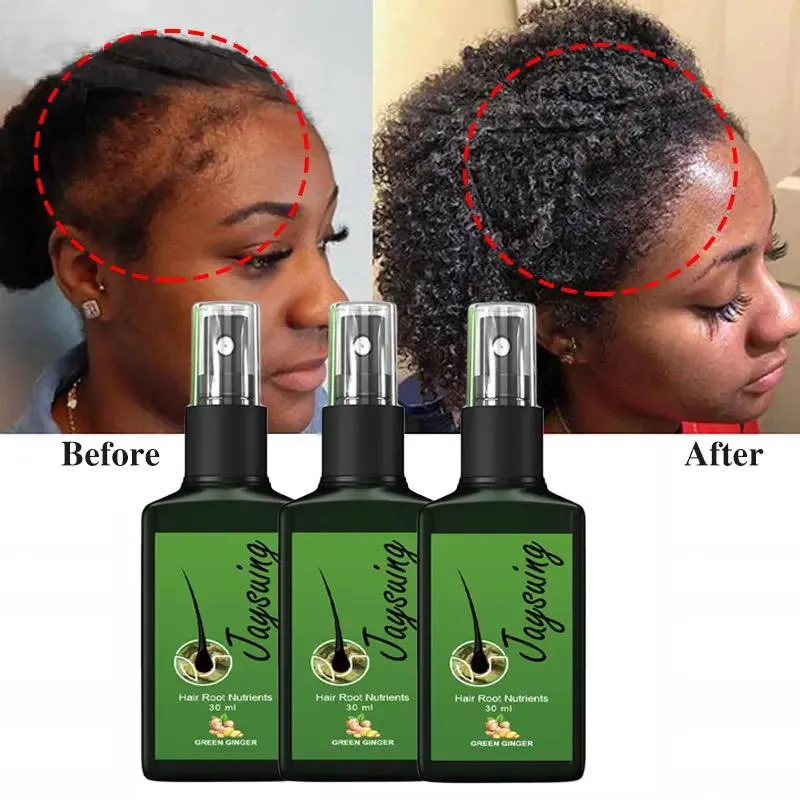 Natural Ginger Hair Growth Spray Jaysuing 120ml