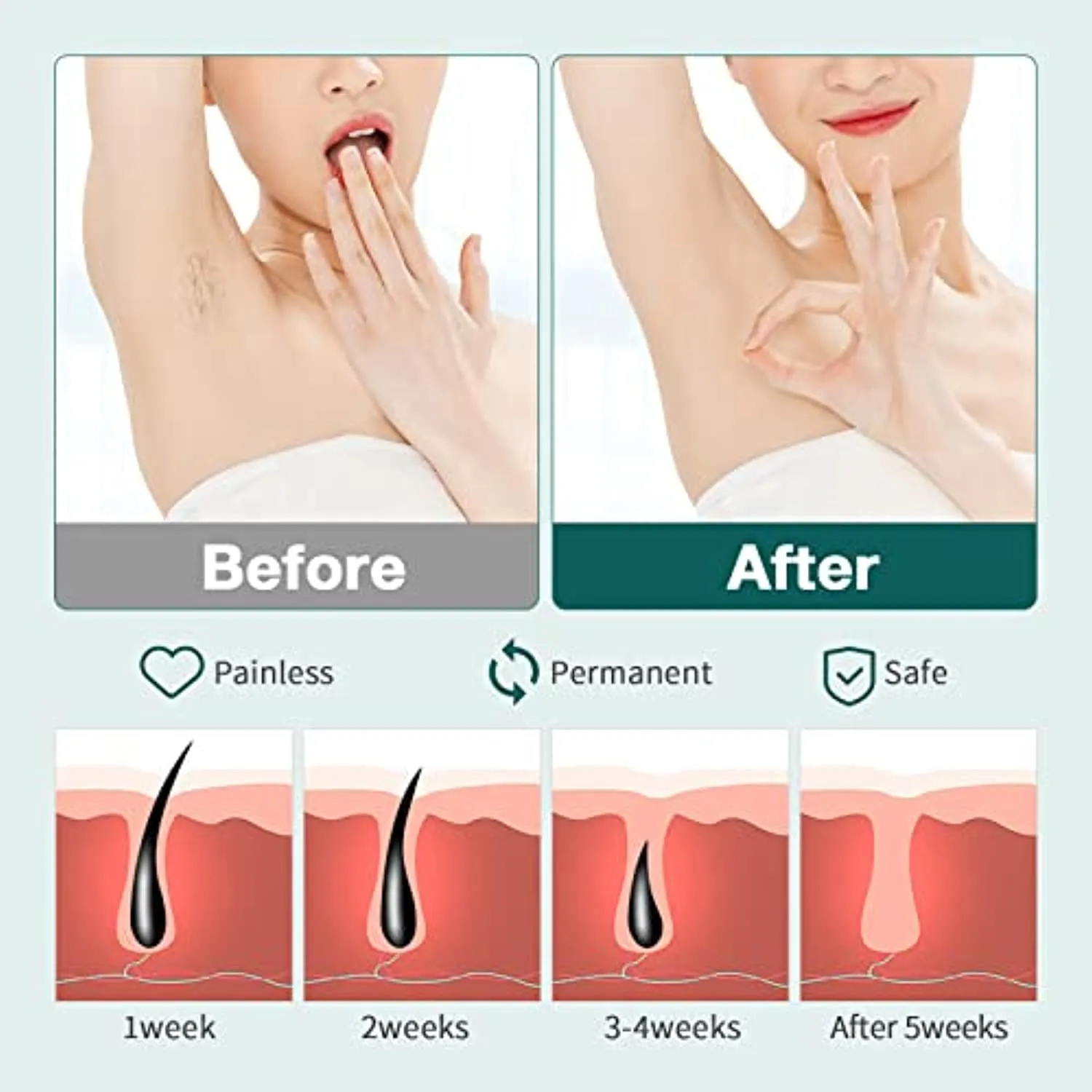 NICEBLE Hair Removal Device with Sapphire Ice-cooling System, Permanent Painless Hair Removal for Women and Men, Upgraded At-Home Hair Remover with Face & Body Mode