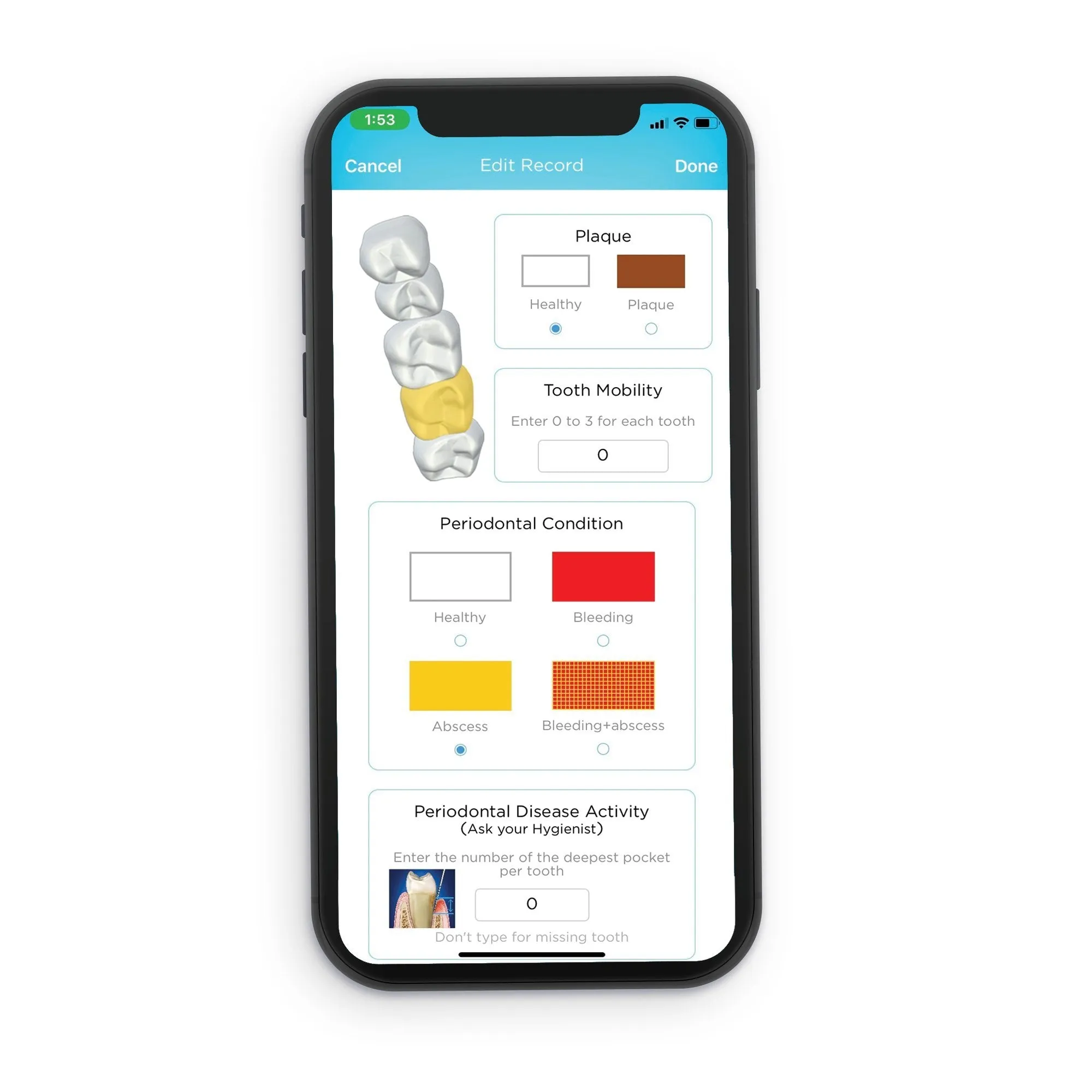 Practice Sample of BLU Smart Toothbrush and APP (White Rose)