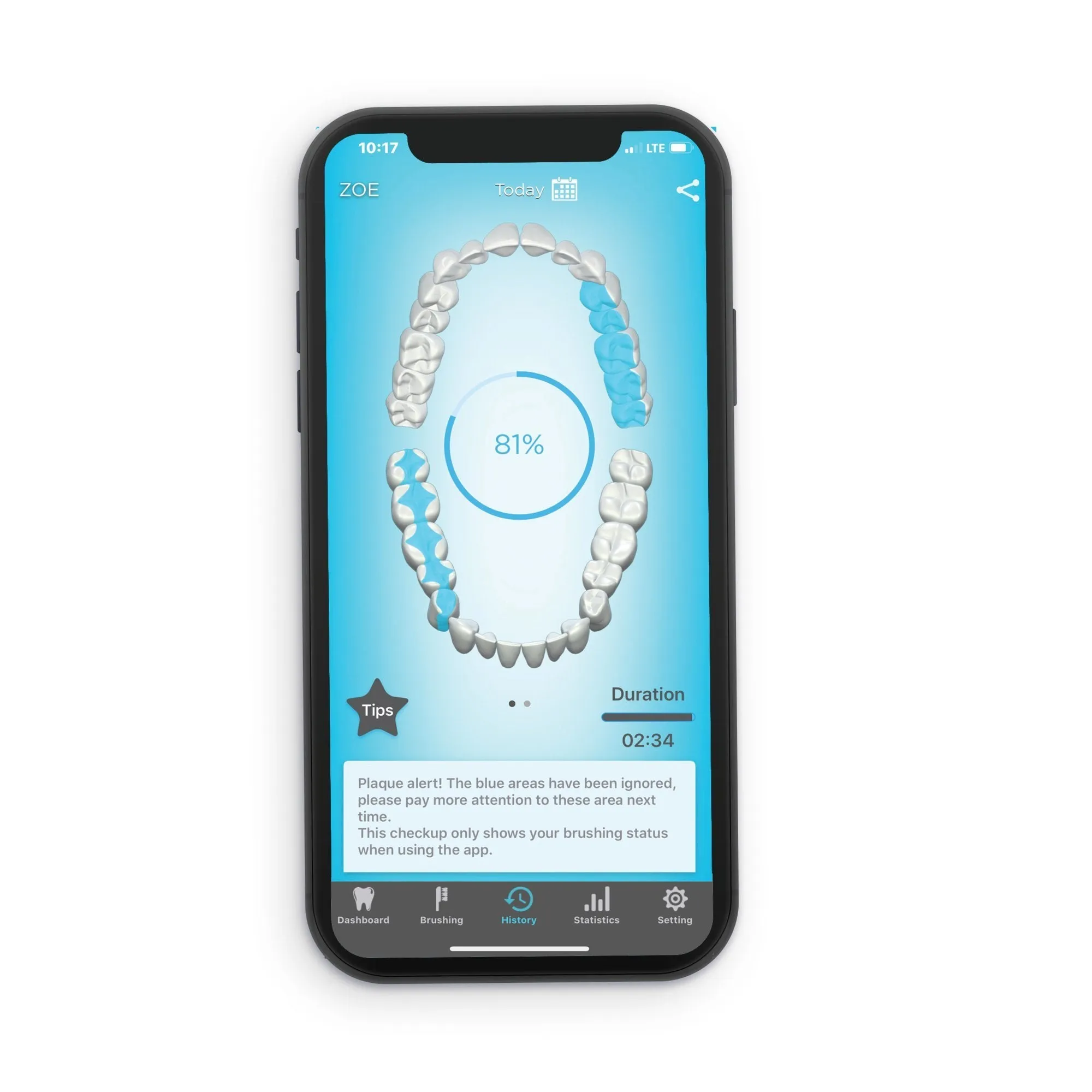 Practice Sample of BLU Smart Toothbrush and APP (White Rose)