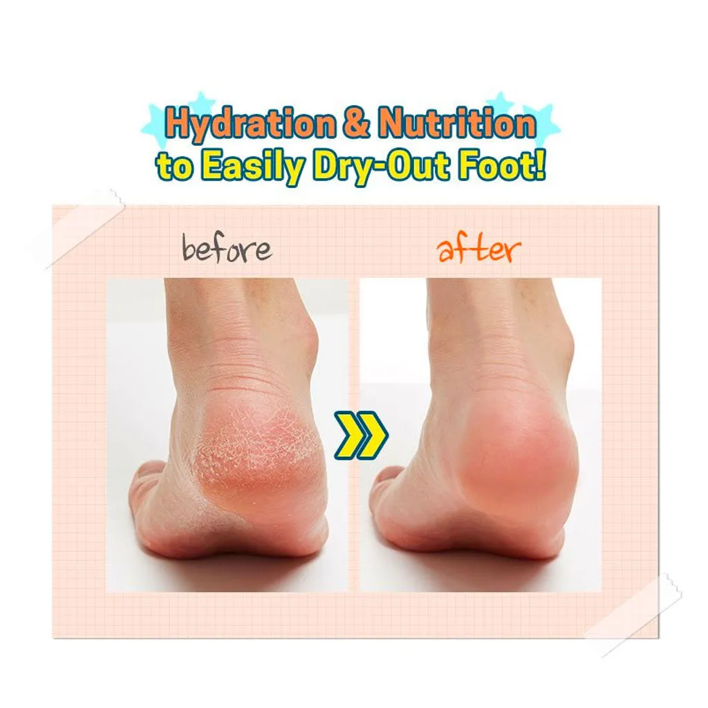 Soft Foot 30 Minute Peeling Socks