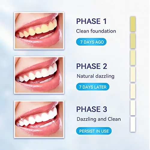 Somall Teeth Whitening Kit - 2024 Newest The Smart Teeth Whitening LED Light System,35% Carbamide Peroxide, (3) 3ml Gel Syringes, (1) Remineralization Desensitizing Gel, and Tray.