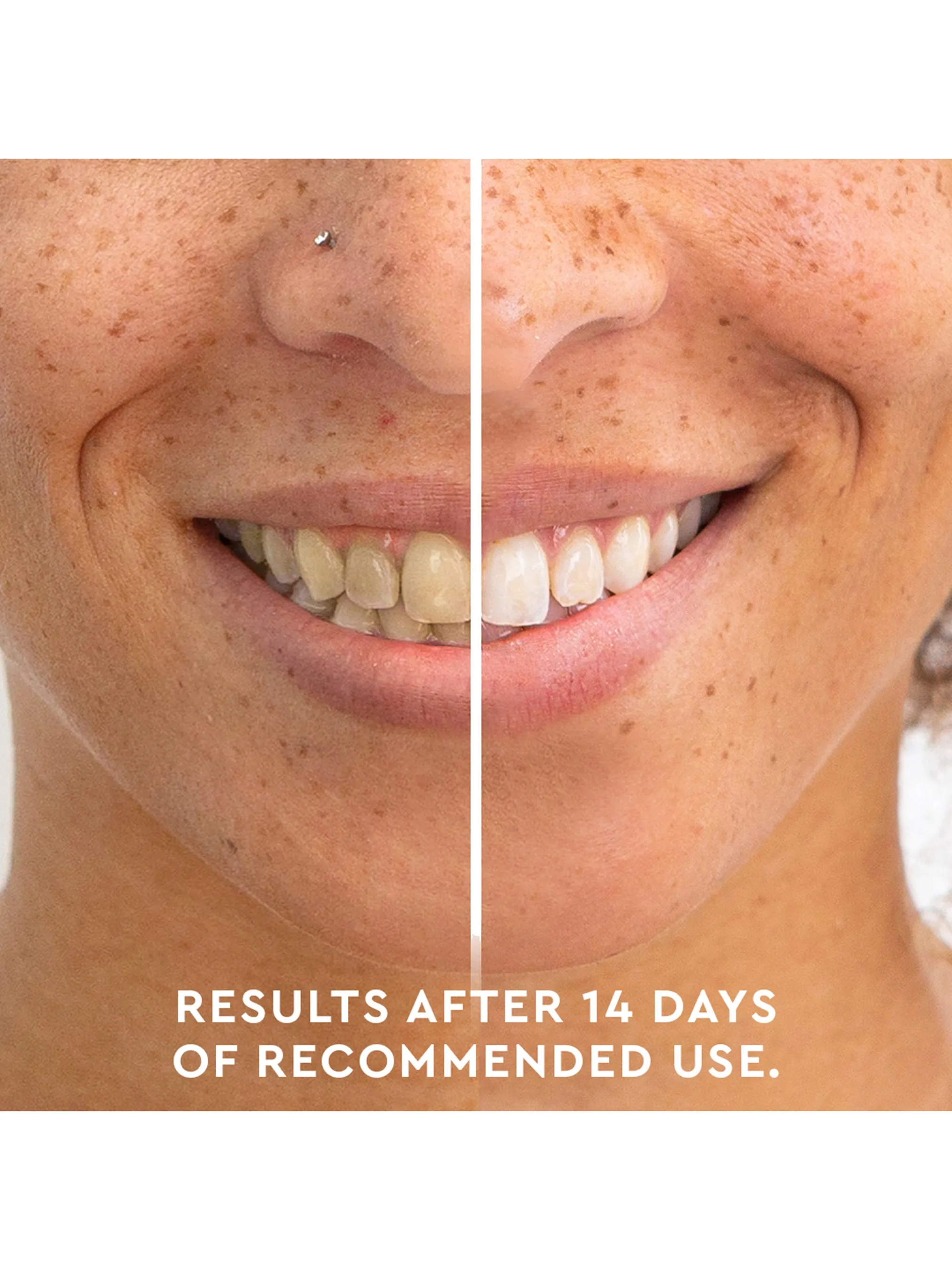 Teeth Whitening Pen Holiday Duo