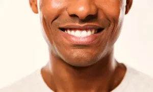 Teeth whitening sessions