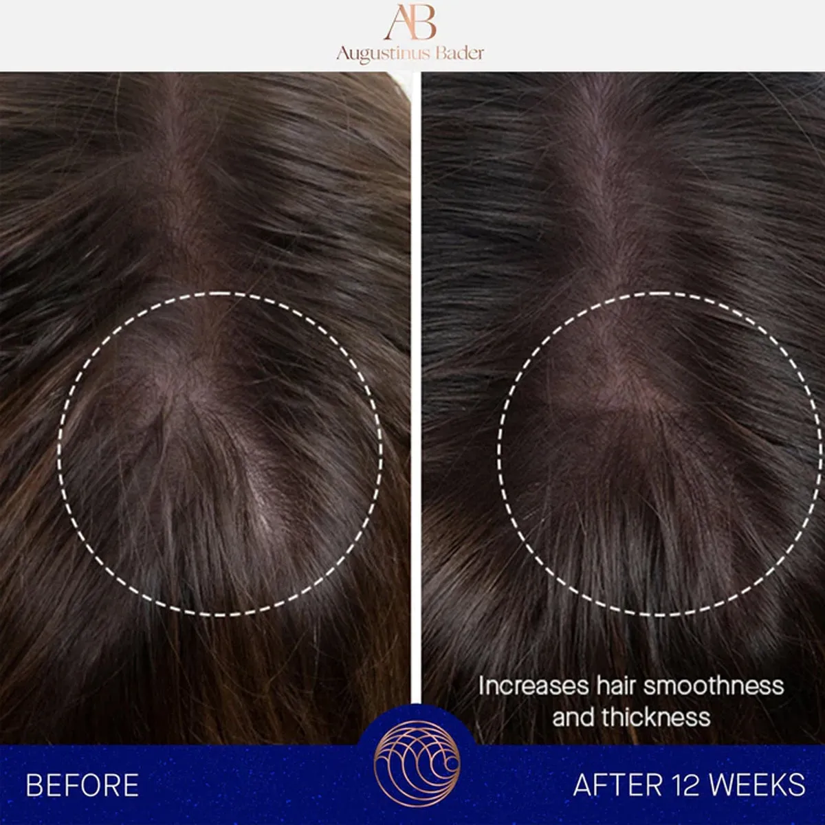 The Leave-in Hair Treatment
