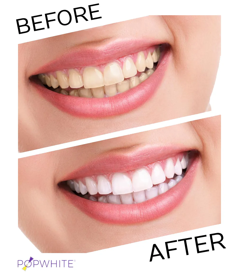 Whitening Oral Rinse [16.9 fl oz]